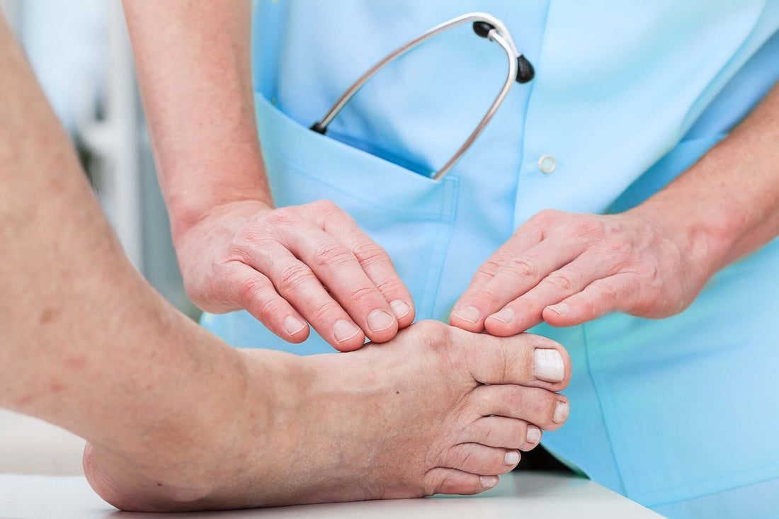 Tips for Smooth Bunion Surgery Recovery