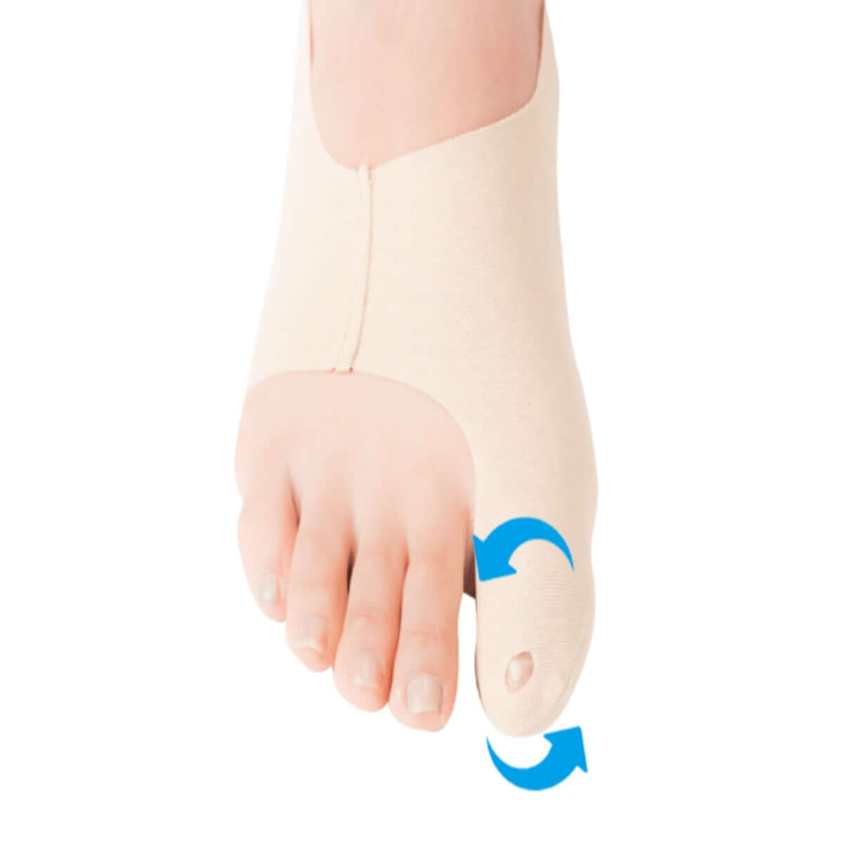 How bunion sleeve straightens the big toe